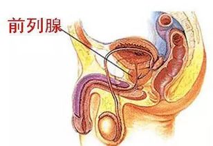前列腺炎要怎么治疗? 前列腺炎要怎么治疗?