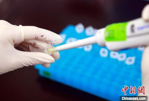 韩国疫情最新情况3月4日（韩国疫情最新情况3月4日怎么样）