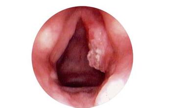 美国1.1万孕妇感染新冠（美国用孕妇做新冠实验）