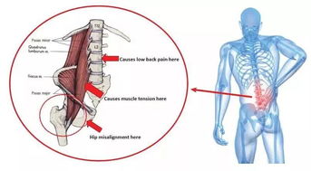 如何拉伸腰椎?怎样拉伸腰椎