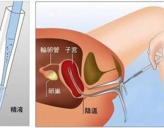人工受精如何采精?人工受精是怎样取的卵