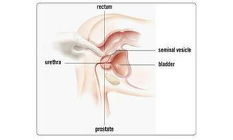 男性如何潮喷?按摩前列腺手法视频