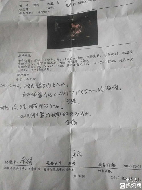 24-5数学凑十法怎么算？（24-5）