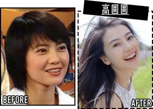 你如何看待整容热?如何看待整容热潮即评 你如何看待整容热?如何看待整容热潮即评