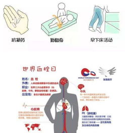 如何预防术后静脉血栓?预防术后静脉血栓的药物