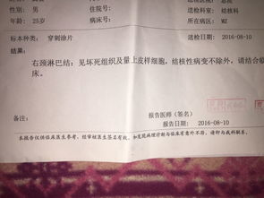 结核性脑膜炎如何检查?结核性脑膜炎查什么可以确诊