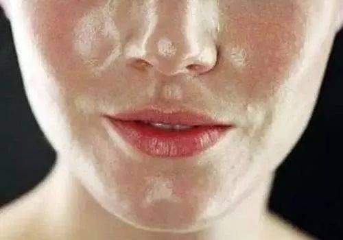 如何辨别皮肤是表层缺水还是深层缺水?如何看皮肤是否缺水