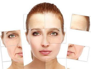 面部除皱效果如何?面部除皱用什么方法