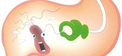 如何治慢性胃病?慢性胃病怎么调理比较好