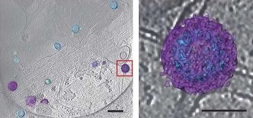 酵母菌如何观察?酵母菌的显微观察方法