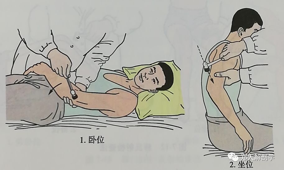 如何检查拥抱反射?拥抱反射减弱的表现