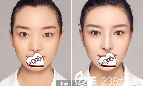 如何做整形业务员?整形业务员好做吗 如何做整形业务员?整形业务员好做吗