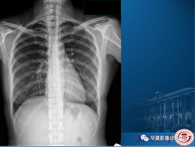 手把手教你如何揉胸?手把手教你如何揉胸部