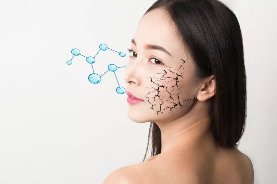 如何改善皮肤?如何改善皮肤暗沉发黄