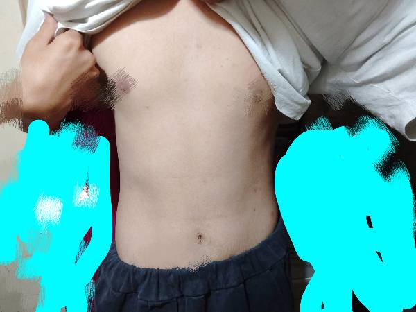 肩膀比较厚有什么解决办法？（肩膀宽怎么办）